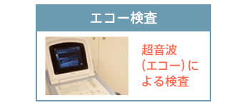 エコー検査：超音波（エコー）による検査