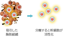 吸引した脂肪組織→分離すると幹細胞が活性化