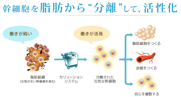 幹細胞を脂肪から“分離”して、活性化 働きが鈍い 脂肪組織（元気のない幹細胞を含む） セリューションシステム 働きが活発 分離された元気な幹細胞 脂肪細胞をつくる 血管をつくる 自らを複製する
