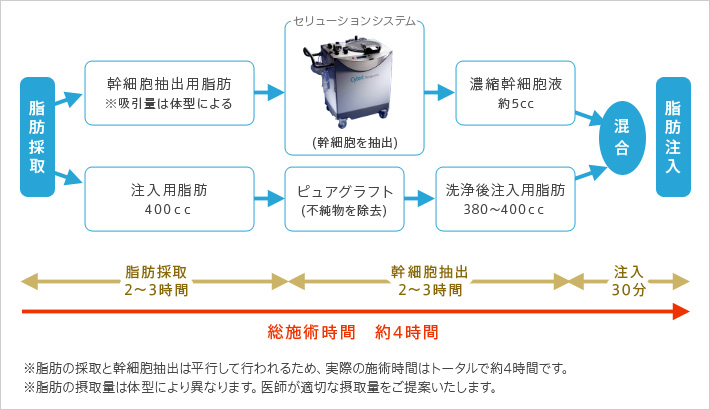 脂肪採取2～3時間、幹細胞抽出2～3時間、注入30分、総施術時間約4時間