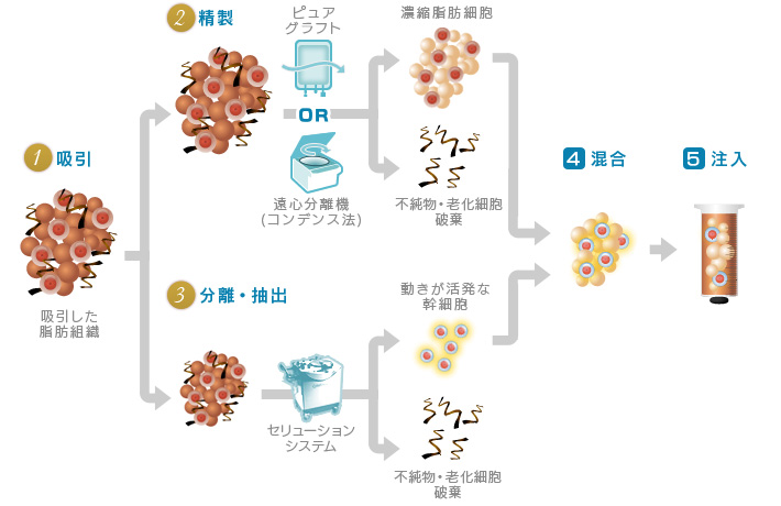 1.吸引 2.精製 3.分離・抽出 4.混合 5.注入