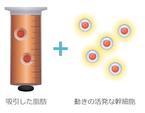 吸引した脂肪 動きの活発な幹細胞