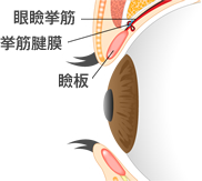 眼瞼下垂とは？