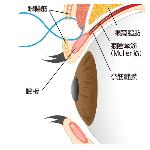 手術