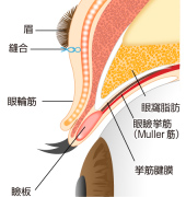 横から見た図 施術後