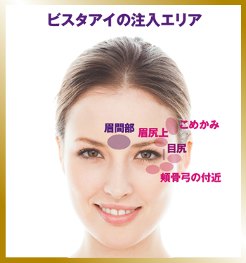 ビスタシェイプの注入エリア