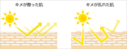 キメが整った肌,キメが乱れた肌