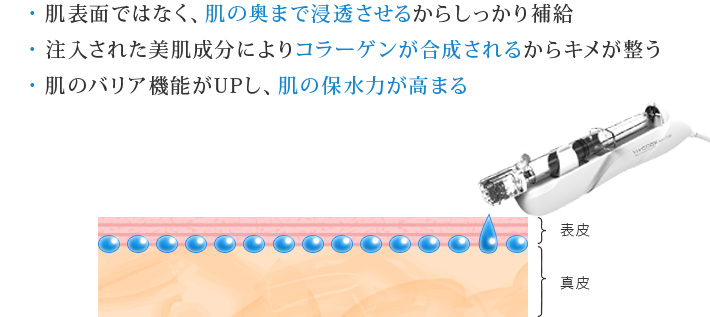 ・肌表面ではなく、肌の奥まで浸透させるからしっかり補給 ・注入された美肌成分によりコラーゲンが合成されるからキメが整う ・肌のバリア機能がUPし、肌の保水力が高まる