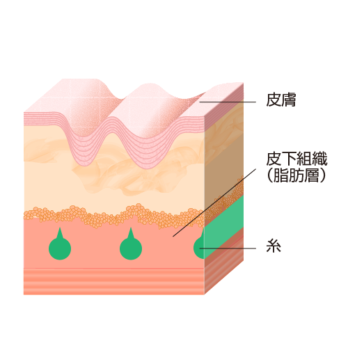 皮膚 皮下組織（脂肪層） 糸