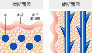 横断面図 縦断面図