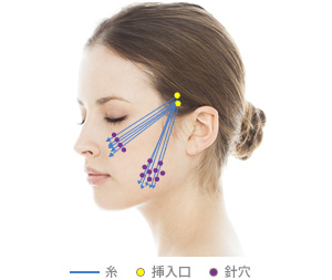 糸 挿入口 針穴