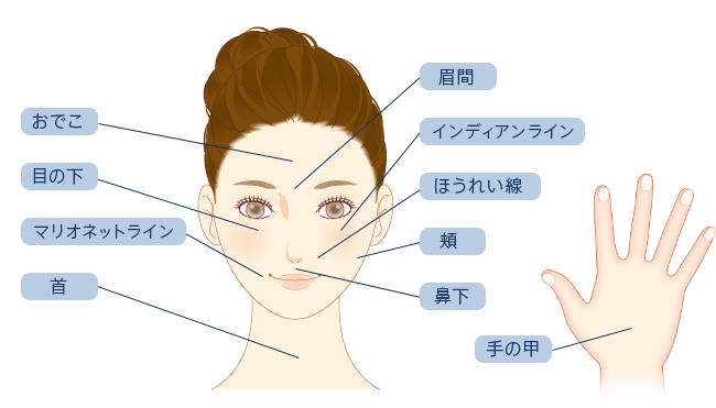 おでこ、眉間、目の下、インディアンライン、マリオネットライン、ほうれい線、頬、鼻下、首、手の甲