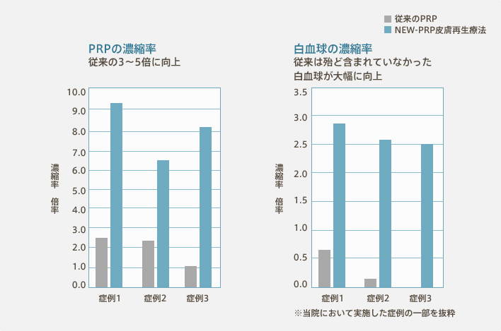 PRPの濃縮率：従来の3～5倍に向上、白血球の濃縮率：従来は殆ど含まれていなかった白血球が大幅に向上