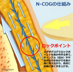 N-COGの仕組み ロックポイント ジグザグコグでロックポイントを数か所作る事で、ディンプル (凹み)や不自然な引きあがりを最小限に抑えながら、自然に綺麗に強く引き上げる。