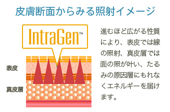 皮膚断面からみる照射イメージ：進むほど広がる性質により、表皮では線の照射、真皮層では面の照射が叶い、たるみの原因層にもれなくエネルギーを届けます。