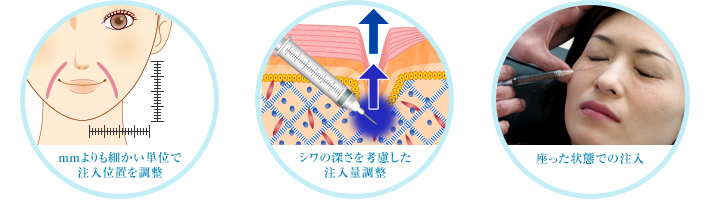 ・mmよりも細かい単位で注入位置を調整 ・シワの深さを考慮した注入量調整 ・座った状態での注入