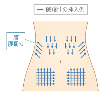 適応部位 腹 腰周り