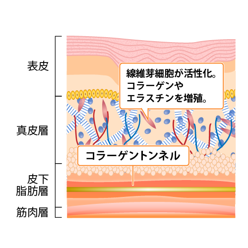 線維芽細胞が活性化。コラーゲンやエラスチンを増殖。