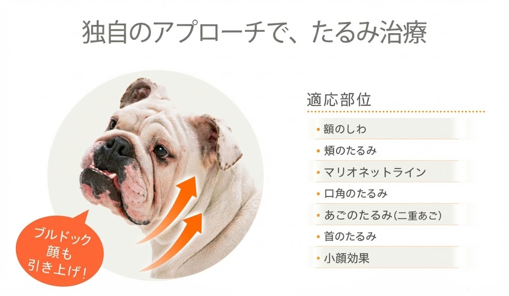今までなかった、たるみ治療 適応部位 ・額のしわ ・頬のたるみ ・マリオネットライン ・口角のたるみ ・あごのたるみ(二重あご) ・首のたるみ ・小顔効果 ブルドッグ顔も引き上げ!