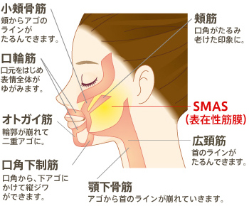 SMAS（表在性筋膜）　頬筋:口角がたるみ老けた印象に。 小頬骨筋:頬からアゴのラインがたるんできます。 口輪筋:口元をはじめ表情全体がゆがみます。 オトガイ筋:輪郭が崩れて二重アゴに。 口角下制筋:口角から、下アゴにかけて縦ジワができます。 顎下骨筋:アゴから首のラインが崩れていきます。