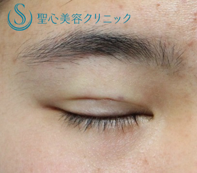 症例写真