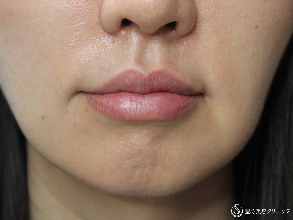 唇、口のポップアート 無料画像 - Public Domain Pictures