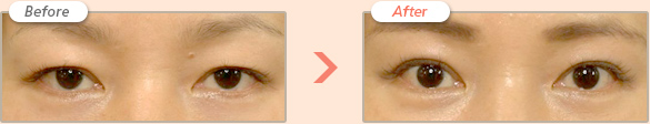 Before → After