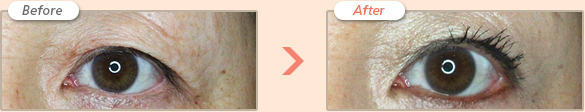 Before → After