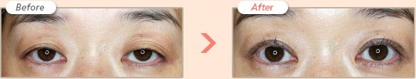 Before → After