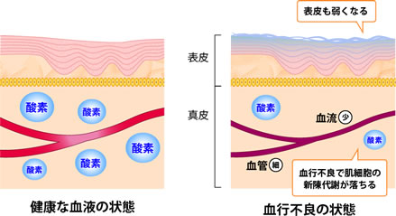 健康な血液の状態,血行不良の状態