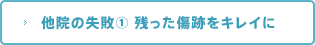 他院の失敗① 残った傷跡をキレイに