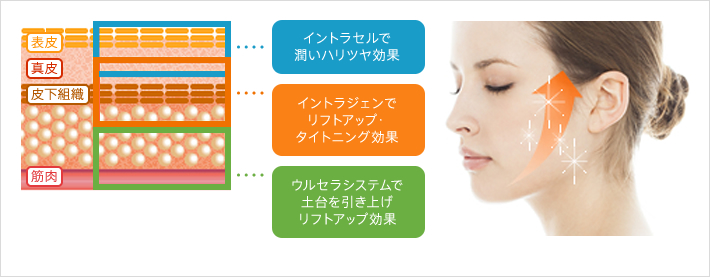 肌質改善とリフトアップが可能