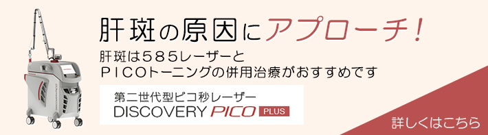 肝斑の原因にアプローチ！肝斑は585レーザーとPICOトーニングの併用治療がおすすめです。第二世代型ピコ秒レーザー DISCOVERY PICO PLUS　詳しくはこちら