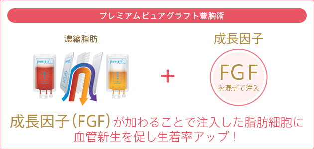 プレミアムピュアグラフト豊胸術 濃縮脂肪 + 成長因子 FGFを混ぜて注入 成長因子（FGF）が加わることで注入した脂肪細胞に血管新生を促し生着率アップ！