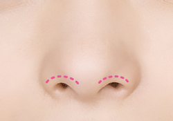 理想的な鼻の穴は緩やかなアーチ型