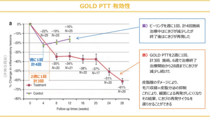 【GOLD PTTの有効性】ピーリングを週に1回、計4回施術：治療中はにきびが減少したが終了後にはにきびが再発した。 GOLD PTTを2週に1回、計3回施術。6週で治療終了。：皮脂腺のダメージにより、毛穴収縮+皮脂分泌の抑制。これにより、最近による再発がしにくくなり、その結果、にきびの再発サイクルを遅らせることができる