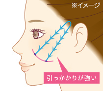 アンカーDXダブル 引っかかりが強い