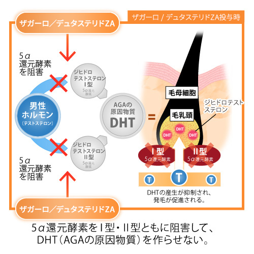 ザガーロ／デュタステリドZA