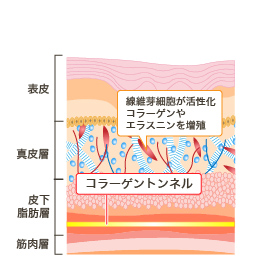 線維芽細胞が活性化 コラーゲンやエラスニンを増殖 コラーゲントンネル