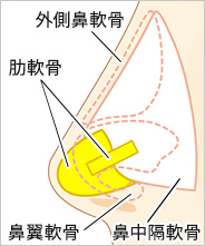 移植