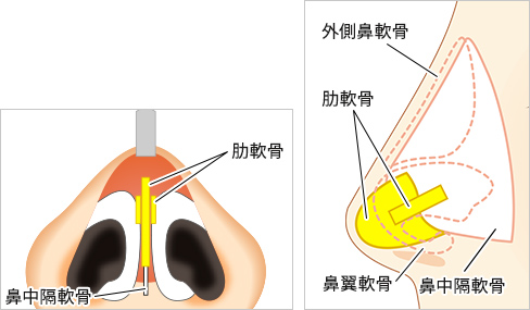 術後の安定感