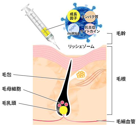 Richexosome リッシェゾーム 美容整形 美容外科 美容皮膚科なら聖心美容クリニック Richexosome リッシェゾーム 美容整形 美容外科 美容皮膚科なら聖心美容クリニック