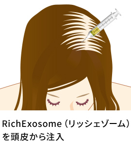 RichExosome（リッシェゾーム）毛髪再生治療とは