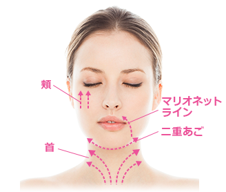 TESSリフト（テスリフト）の適応部位