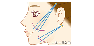 外科（糸）