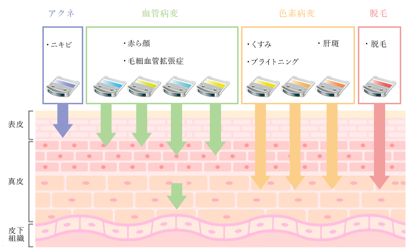 多彩な波長を組み合わせて自分仕様のスキンケア治療