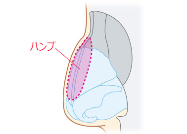 鼻骨骨切り+ハンプ切除_骨の構造