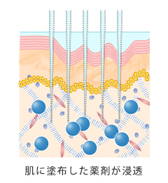 ダーマペン4_肌に塗布した薬剤が浸透