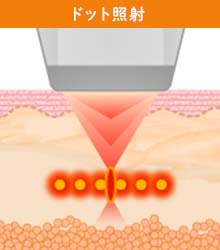 【顔全体のリフトアップ】効果のメカニズム
