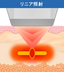 【二重アゴ解消&小顔効果】効果のメカニズム